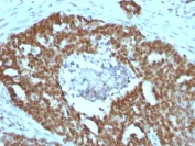 Immunohistochemistry (Formalin/PFA-fixed paraffin-embedded sections) - Anti-Nucleolin antibody [NCL/902] - BSA and Azide free (AB216006)