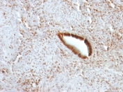 Immunohistochemistry (Formalin/PFA-fixed paraffin-embedded sections) - Anti-Nucleolin antibody [NCL/902] - BSA and Azide free (ab216006), expandable thumbnail