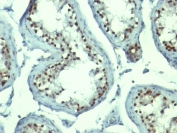 Immunohistochemistry (Formalin/PFA-fixed paraffin-embedded sections) - Anti-Nucleolin antibody [NCL/902] - BSA and Azide free (AB216006), expandable thumbnail