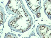 Immunohistochemistry (Formalin/PFA-fixed paraffin-embedded sections) - Anti-Nucleolin antibody [NCL/902] - BSA and Azide free (AB216006)