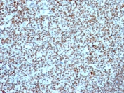 Immunohistochemistry (Formalin/PFA-fixed paraffin-embedded sections) - Anti-Nucleolin antibody [NCL/902] - BSA and Azide free (ab216006), expandable thumbnail