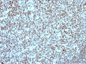 Immunohistochemistry (Formalin/PFA-fixed paraffin-embedded sections) - Anti-Nucleolin antibody [NCL/902] - BSA and Azide free (AB216006)