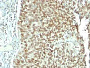 Immunohistochemistry (Formalin/PFA-fixed paraffin-embedded sections) - Anti-Nucleolin antibody [NCL/902] - BSA and Azide free (AB216006)