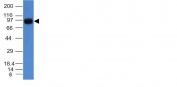 Western blot - Anti-Nucleolin antibody [NCL/902] - BSA and Azide free (AB216006), expandable thumbnail