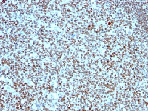 Immunohistochemistry (Formalin/PFA-fixed paraffin-embedded sections) - Anti-Nucleolin antibody [SPM614] - BSA and Azide free (AB212671)