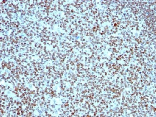 Immunohistochemistry (Formalin/PFA-fixed paraffin-embedded sections) - Anti-Nucleolin antibody [SPM614] - BSA and Azide free (AB212671)