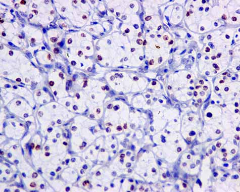 Immunohistochemistry (Formalin/PFA-fixed paraffin-embedded sections) - Anti-Nucleolin (phospho T76) antibody [EPR8080-2] - BSA and Azide free (AB249459), expandable thumbnail