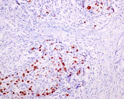 Immunohistochemistry (Formalin/PFA-fixed paraffin-embedded sections) - Anti-Nucleolin (phospho T76) antibody [EPR8080-2] - BSA and Azide free (AB249459)