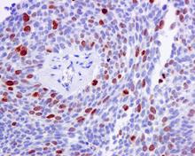 Immunohistochemistry (Formalin/PFA-fixed paraffin-embedded sections) - Anti-Nucleolin (phospho T76) antibody [EPR8080-2] - BSA and Azide free (ab249459), expandable thumbnail