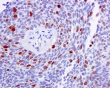 Immunohistochemistry (Formalin/PFA-fixed paraffin-embedded sections) - Anti-Nucleolin (phospho T76) antibody [EPR8080-2] - BSA and Azide free (AB249459)
