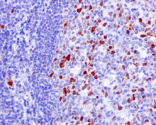 Immunohistochemistry (Formalin/PFA-fixed paraffin-embedded sections) - Anti-Nucleolin (phospho T76) antibody [EPR8080-2] - BSA and Azide free (ab249459), expandable thumbnail