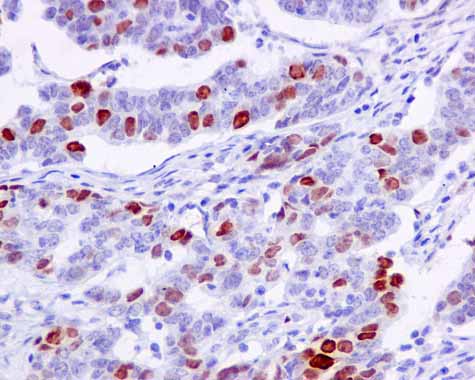 Immunohistochemistry (Formalin/PFA-fixed paraffin-embedded sections) - Anti-Nucleolin (phospho T76) antibody [EPR8080-2] - BSA and Azide free (AB249459), expandable thumbnail