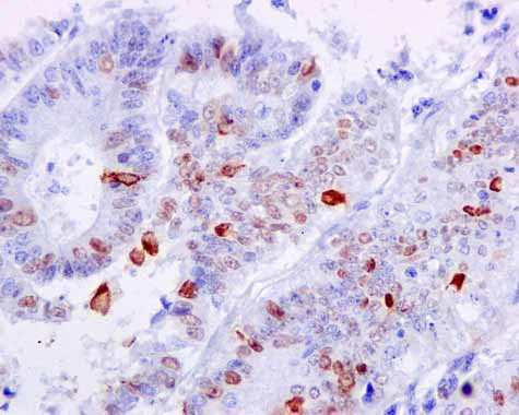 Immunohistochemistry (Formalin/PFA-fixed paraffin-embedded sections) - Anti-Nucleolin (phospho T76) antibody [EPR8080-2] - BSA and Azide free (AB249459)