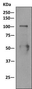 Immunoprecipitation - Anti-Nucleolin (phospho T76) antibody [EPR8080-2] - BSA and Azide free (AB249459)