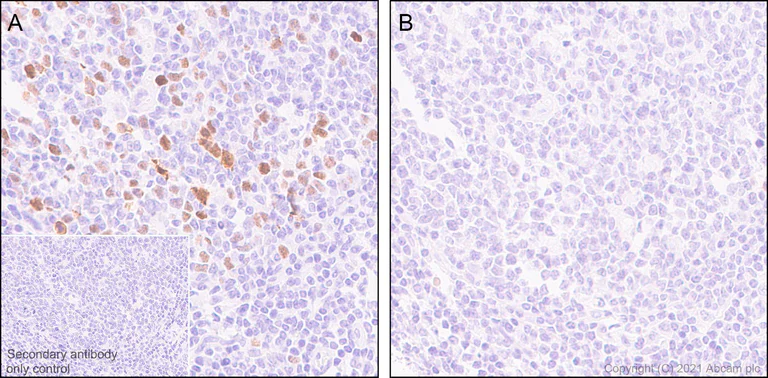 Immunohistochemistry (Formalin/PFA-fixed paraffin-embedded sections) - Anti-Nucleolin (phospho T84) antibody [EPR8080] (AB155977)
