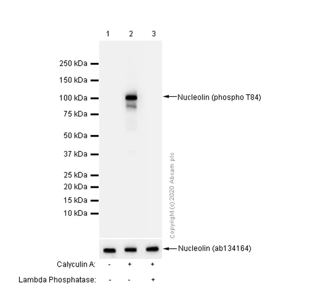 Western blot - Anti-Nucleolin (phospho T84) antibody [EPR8080] (AB155977)