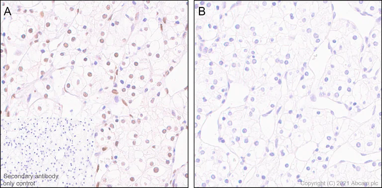 Immunohistochemistry (Formalin/PFA-fixed paraffin-embedded sections) - Anti-Nucleolin (phospho T84) antibody [EPR8080] - BSA and Azide free (AB233474)