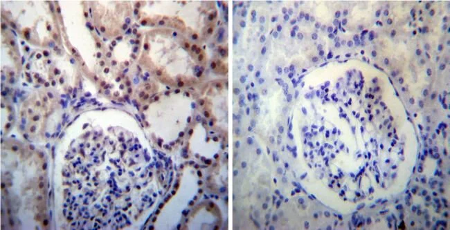 Immunohistochemistry (Formalin/PFA-fixed paraffin-embedded sections) - Anti-Nucleophosmin antibody (AB15440)