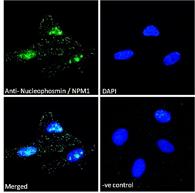 Immunocytochemistry/ Immunofluorescence - Anti-Nucleophosmin antibody (AB31319), expandable thumbnail