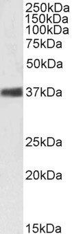 Western blot - Anti-Nucleophosmin antibody (AB31319), expandable thumbnail
