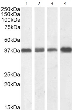 Western blot - Anti-Nucleophosmin antibody (AB31319), expandable thumbnail