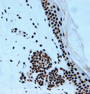 Immunohistochemistry (Formalin/PFA-fixed paraffin-embedded sections) - Anti-Nucleophosmin antibody (AB37659)
