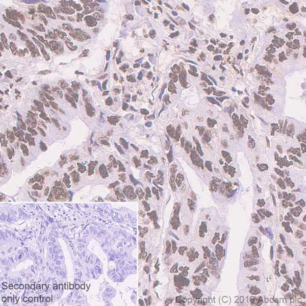 Anti-Nucleophosmin antibody [EP1848Y] (ab52644) | Abcam