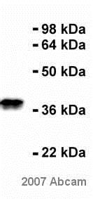 Western blot - Anti-Nucleophosmin antibody [FC82291] (AB10530), expandable thumbnail