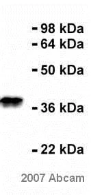 Western blot - Anti-Nucleophosmin antibody [FC82291] (AB10530)