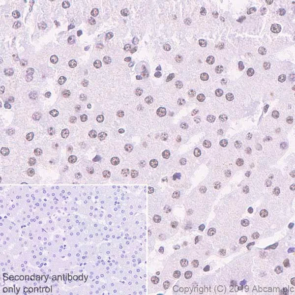 Immunohistochemistry (Formalin/PFA-fixed paraffin-embedded sections) - Anti-Nucleophosmin antibody [NA24] (BSA and Azide free) (AB256124)
