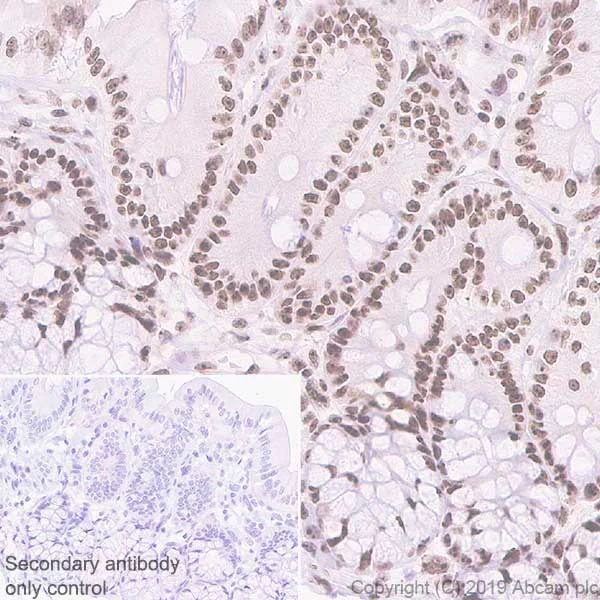 Immunohistochemistry (Formalin/PFA-fixed paraffin-embedded sections) - Anti-Nucleophosmin antibody [NA24] (BSA and Azide free) (AB256124)