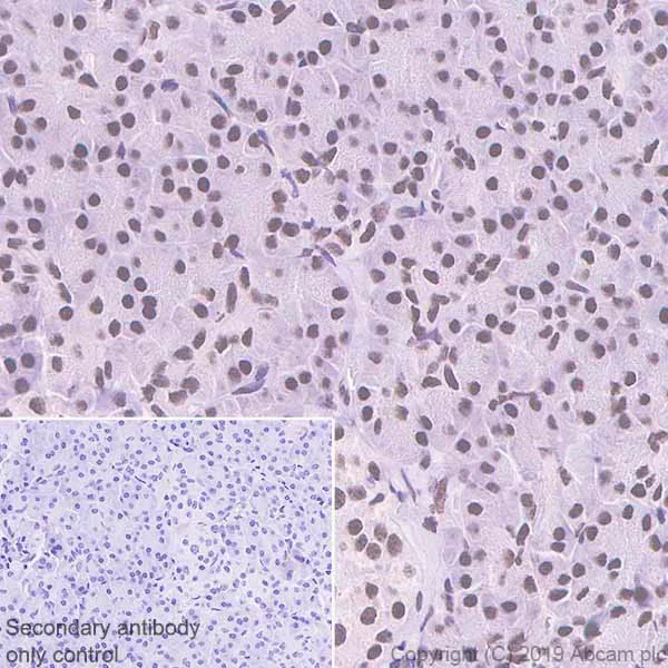 Immunohistochemistry (Formalin/PFA-fixed paraffin-embedded sections) - Anti-Nucleophosmin antibody [NA24] (BSA and Azide free) (AB256124)
