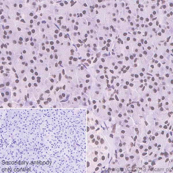 Immunohistochemistry (Formalin/PFA-fixed paraffin-embedded sections) - Anti-Nucleophosmin antibody [NA24] (N-terminal) (AB238029)