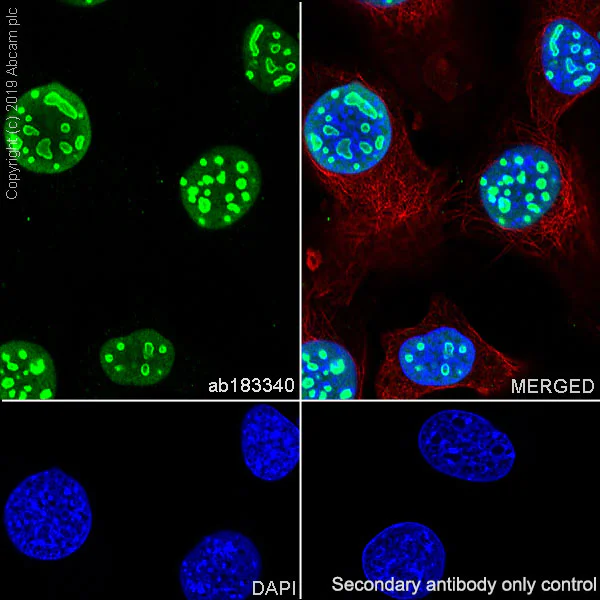 Immunocytochemistry/ Immunofluorescence - Anti-Nucleophosmin antibody [SP236] (AB183340)