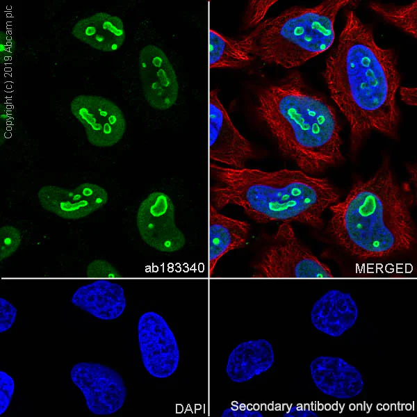 Immunocytochemistry/ Immunofluorescence - Anti-Nucleophosmin antibody [SP236] (AB183340)