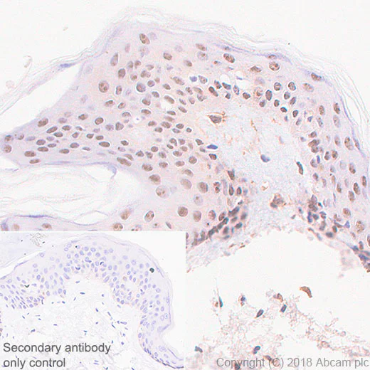 Immunohistochemistry (Formalin/PFA-fixed paraffin-embedded sections) - Anti-Nucleophosmin antibody [SP236] (AB183340)