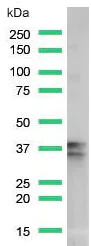 Western blot - Anti-Nucleophosmin antibody [SP236] (AB183340)