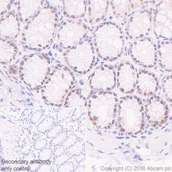 Immunohistochemistry (Formalin/PFA-fixed paraffin-embedded sections) - Anti-Nucleophosmin antibody [SP236] - BSA and Azide free (AB245744)
