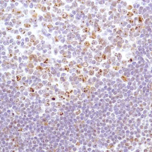 Immunohistochemistry (Formalin/PFA-fixed paraffin-embedded sections) - Anti-Nucleophosmin antibody [SP236] - BSA and Azide free (AB245744)