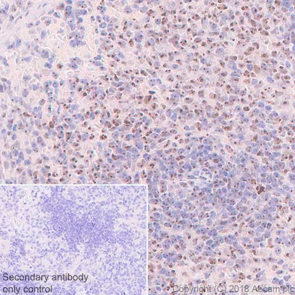 Immunohistochemistry (Formalin/PFA-fixed paraffin-embedded sections) - Anti-Nucleophosmin antibody [SP236] - BSA and Azide free (AB245744)