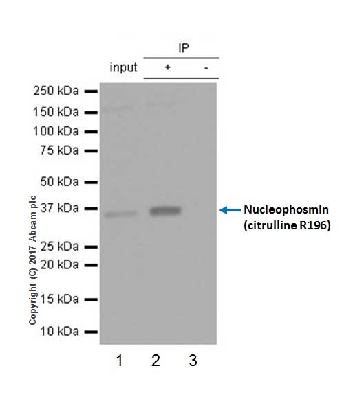 Immunoprecipitation - Anti-Nucleophosmin (citrulline R196) antibody [EPR20172] (AB208015)