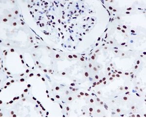 Immunohistochemistry (Formalin/PFA-fixed paraffin-embedded sections) - Anti-Nucleophosmin (phospho S125) antibody [EPR1856] - BSA and Azide free (AB247905)