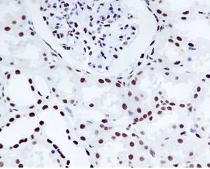 Immunohistochemistry (Formalin/PFA-fixed paraffin-embedded sections) - Anti-Nucleophosmin (phospho S125) antibody [EPR1856] - BSA and Azide free (AB247905)