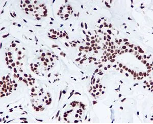 Immunohistochemistry (Formalin/PFA-fixed paraffin-embedded sections) - Anti-Nucleophosmin (phospho S125) antibody [EPR1856] - BSA and Azide free (AB247905)