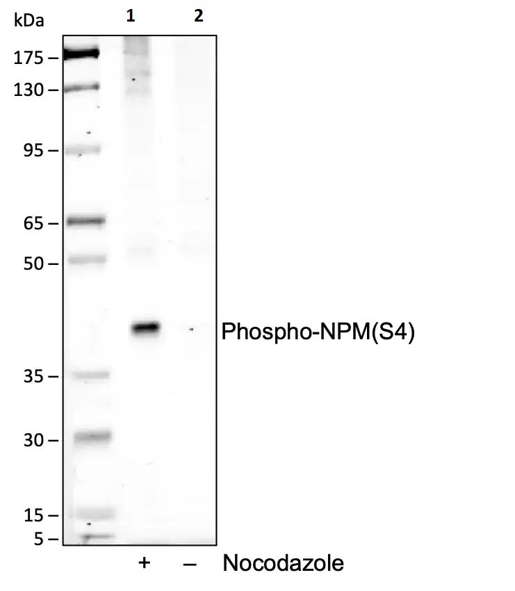 Western blot - Anti-Nucleophosmin (phospho S4) antibody [NPMS4-A1] (AB278648), expandable thumbnail