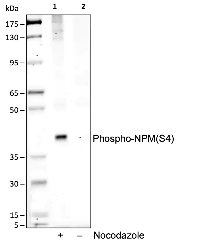 Western blot - Anti-Nucleophosmin (phospho S4) antibody [NPMS4-A1] (AB278648)