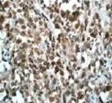 Immunohistochemistry (Formalin/PFA-fixed paraffin-embedded sections) - Anti-Nucleophosmin (phospho T199) antibody [EP1857Y] (AB81551)