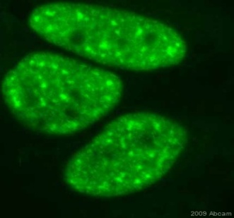 Immunocytochemistry/ Immunofluorescence - Anti-Nucleophosmin (phospho T199) antibody [EP1857Y] - BSA and Azide free (AB208698), expandable thumbnail