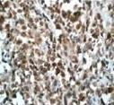 Immunohistochemistry (Formalin/PFA-fixed paraffin-embedded sections) - Anti-Nucleophosmin (phospho T199) antibody [EP1857Y] - BSA and Azide free (AB208698), expandable thumbnail
