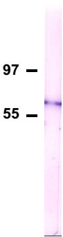 Western blot - Anti-Nucleoporin p62/NUP62 antibody [2A] (AB188413), expandable thumbnail